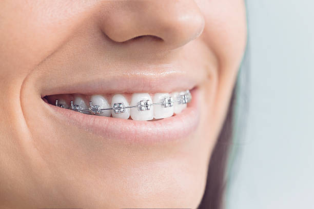 Best Wisdom Tooth Removal  in Seven Oaks, SC